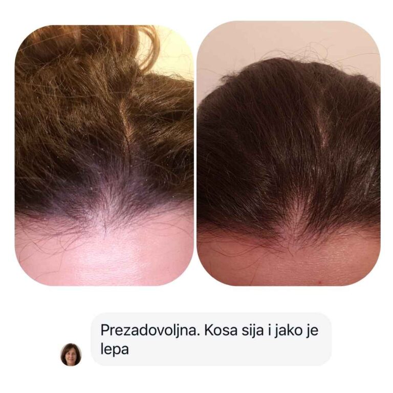 Slika kupca
