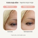Kolagen serum