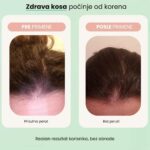 Set protiv opadanja i za rast kose