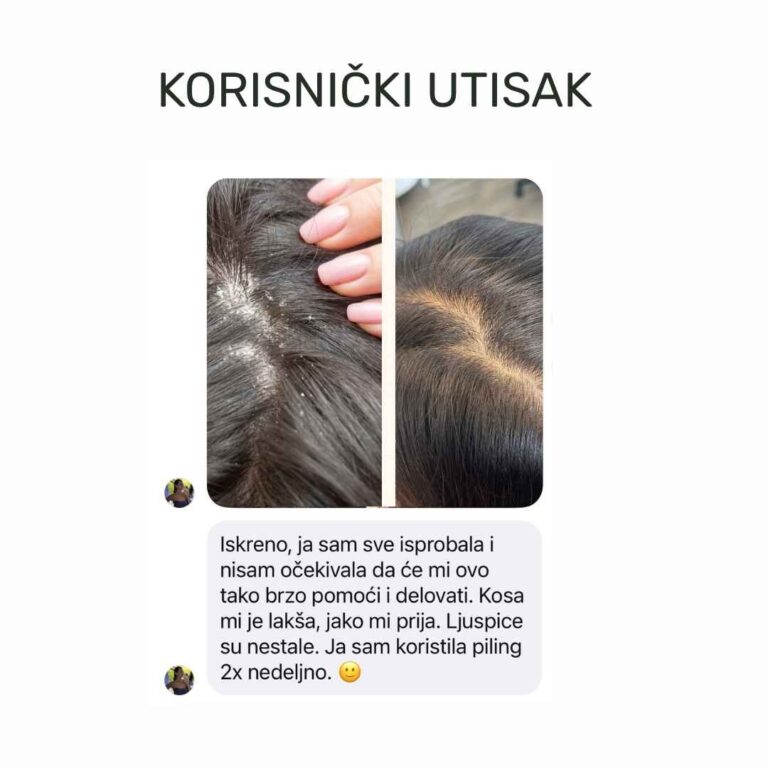 korisnicki utisak
