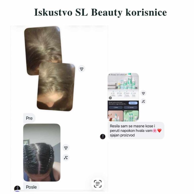 Masna kosa i perut