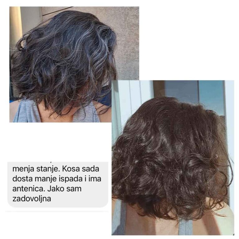 Ruzmarin-Menta ulje za rast kose