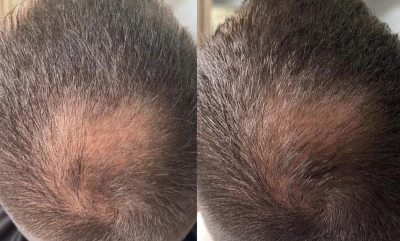 Image #1 from nENAD V.