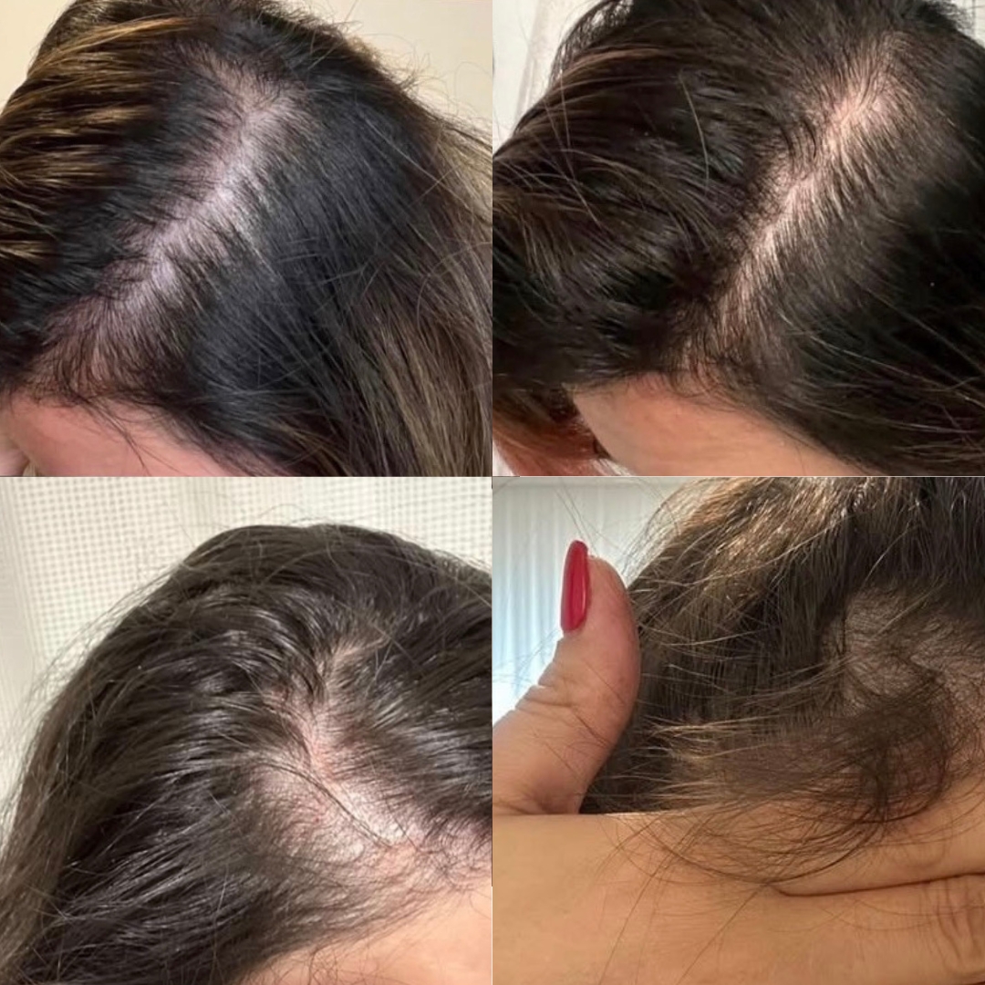 Hair+ Vitamins Skin & Nails