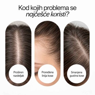 Hair + Skalp Ampula za kosu