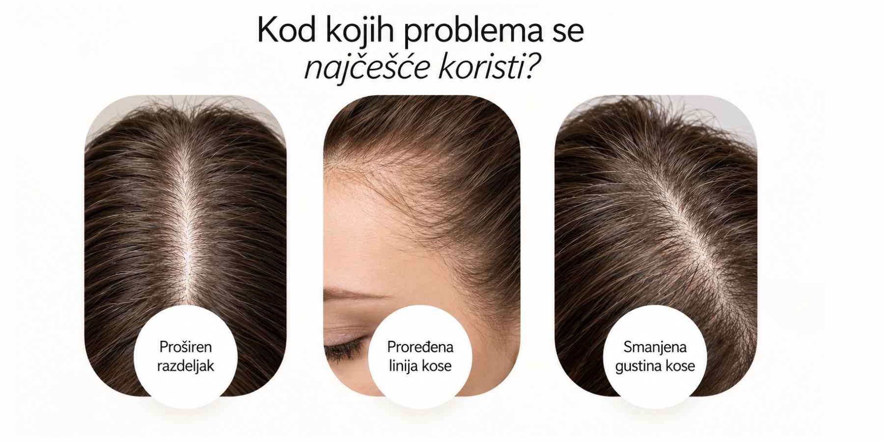sl ampula za kosu